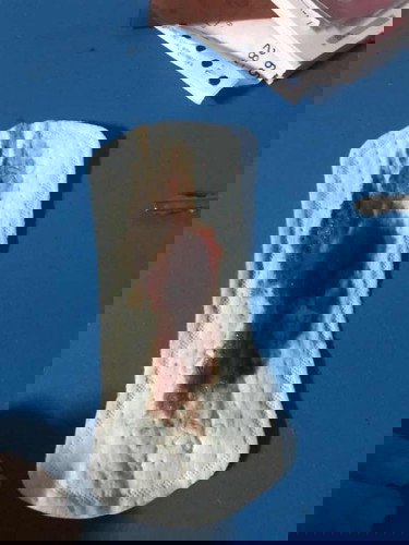 ควรไปหาหมอมั้ย