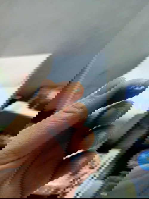 ตกขาวสีน้ำตาลนิดหน่อย