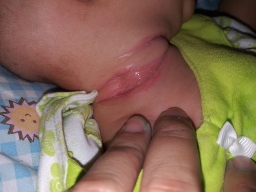คอลูกแดงมีกลิ่น