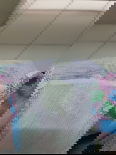 Normal po ba yung discharge ko ?