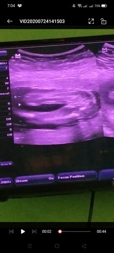 ULTRASOUND