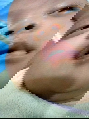 bintik putih