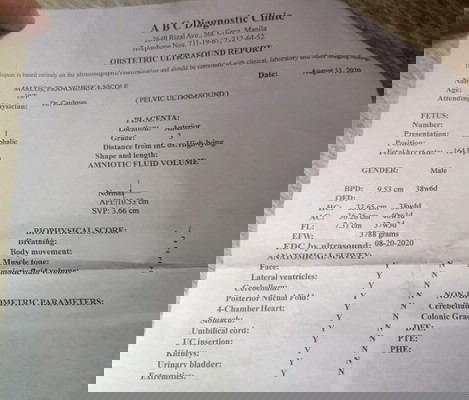 Mga ka momshie kaya po kayang inormal to laki ni baby