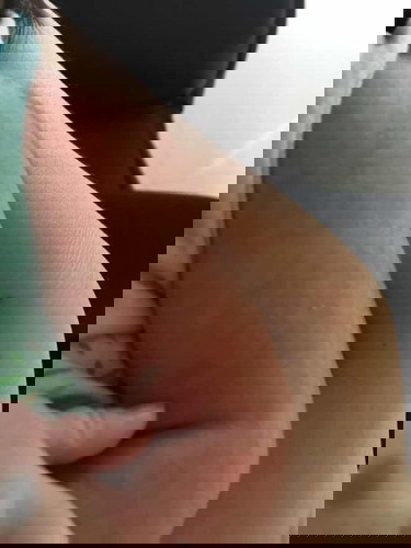 ลูกเป็นผื่นแบบนี้แพ้อะไรค่ะเป็นที่หลังและท้องด้วยค่ะ