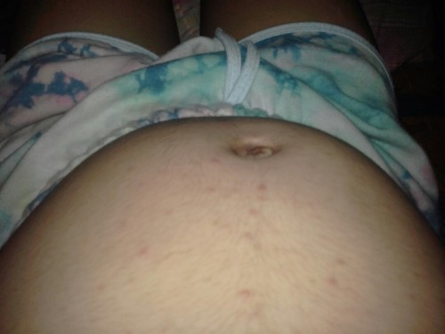 tummy pimples