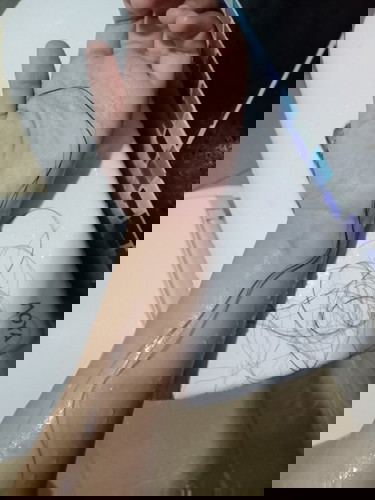 ผมร่วงหนักมาก 😂