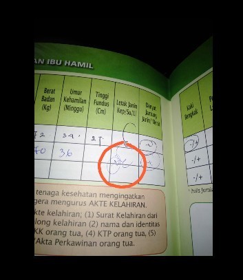 Kode bidan