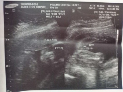 It's a baby boy βοΈ