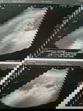 แม่ๆช่วยดูให้หน่อยนะค่ะ ว่าเป็นผู้ชายหรือผู้หญิงค่ะ