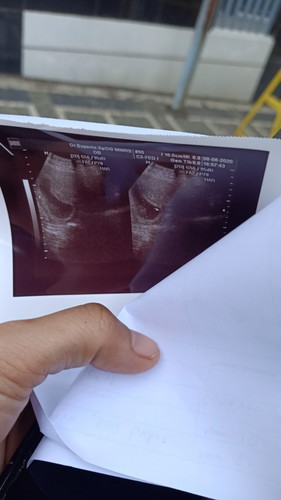 Saya keputihan saat hamil muda