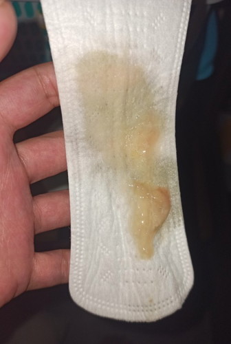 Mucus plug?