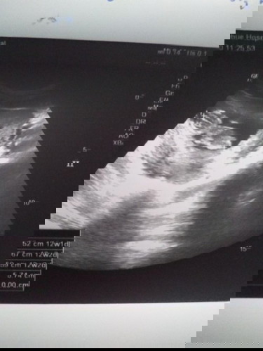 คุณพ่อสงสัย