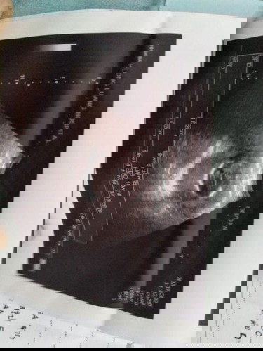 ตรงไหนคือตัวลูกคะ