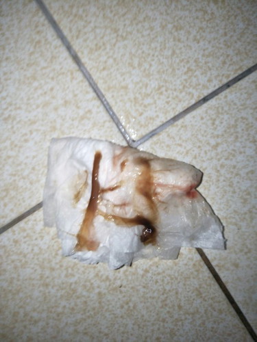 Mucos plug
