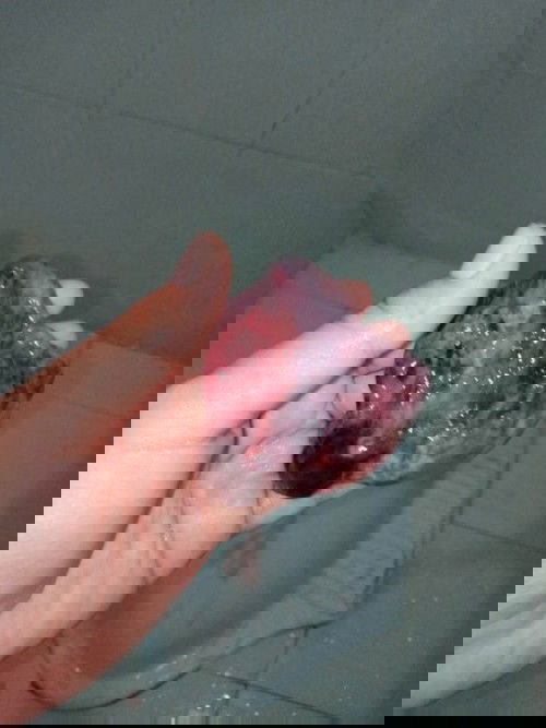 Keguguran ke 2x nya 😔... Yang kemarin aku post hasil USG keliatan kantung aja. ternyata BO. seminggu setelahnya keluar begini