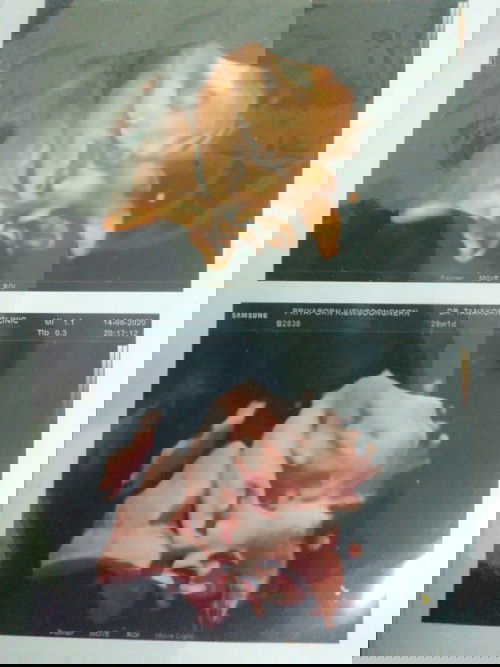 น้องกลับหัวกันตอนกี่เดือนคะแม่ๆ