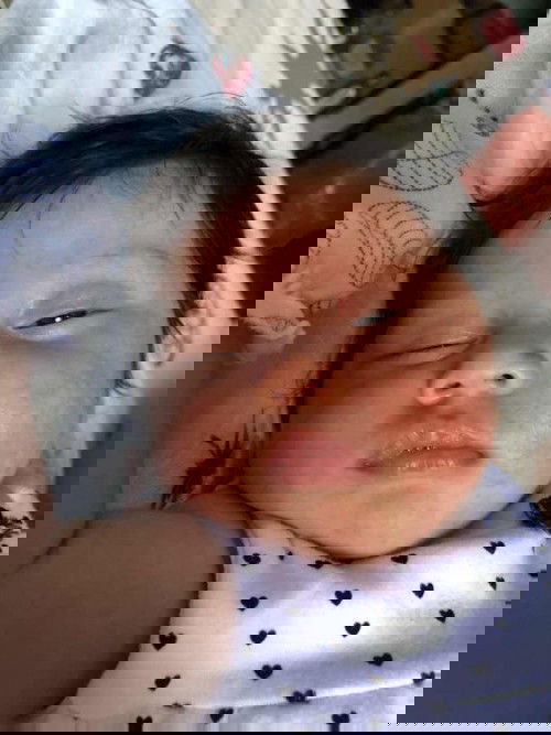 ผื่นขึ้นแบบนี้เรียกว่าอะไรคะ