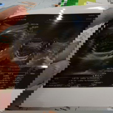 24 Minggu kata dokter Bun,apa kah ini termasuk normal?