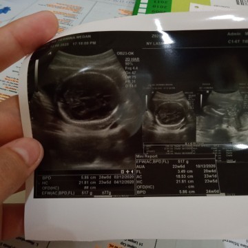 24 Minggu kata dokter Bun,apa kah ini termasuk normal?