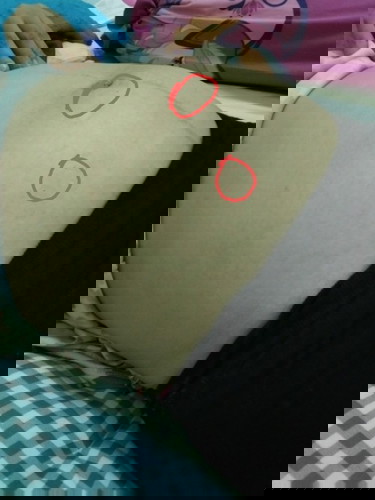 แปลกจังสงไสว่าทำไมเจอเสียงกัวใจเด็กสองจุดไกล้กัน