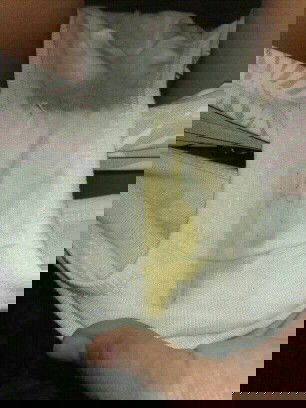 Yellow or green discharged