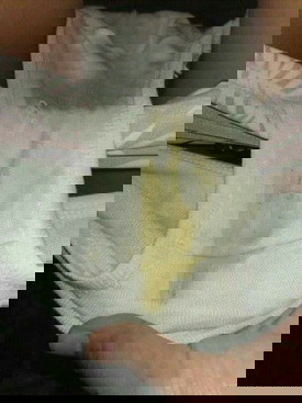 Yellow or green discharged