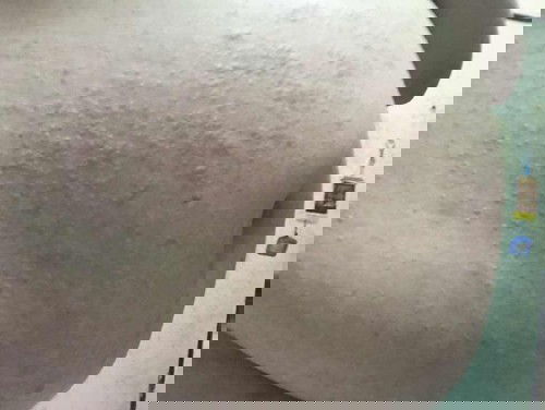 ผืน หรือ ผด หรือ อะไร 😂😂  โครตคัน