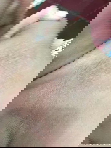 Kulit kering pada bayi