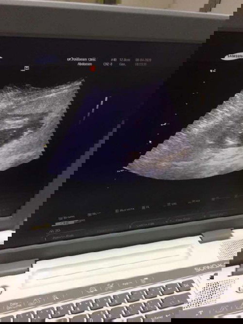 บันทึก 35week