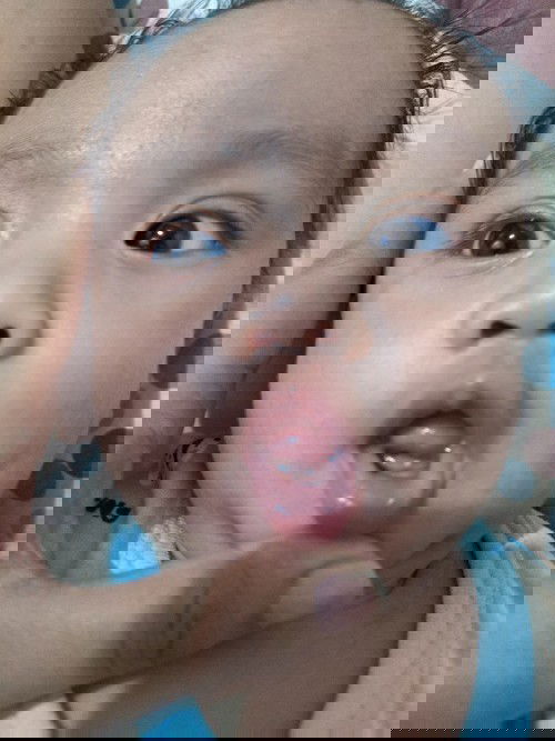 good day, tanong ko lang po kung yung LO nyo is nag karoon na ng ganyn? parang laso? hndi nmn ipin..