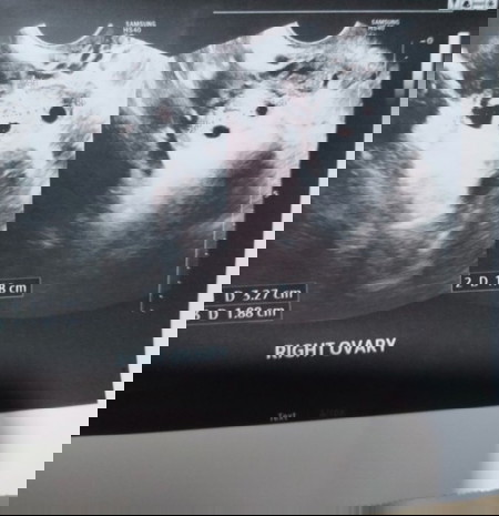 sana magtuloy na 😇