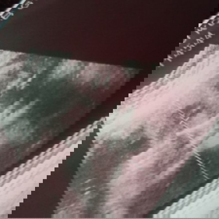 ultrasound
