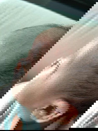 Is this heat rash?