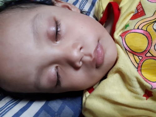 Kelopak mata anak kelihatan hitam