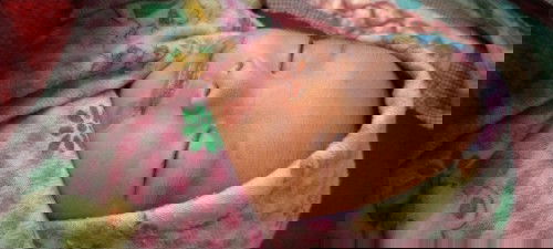 mulut anak saya putih