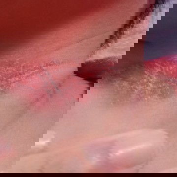 ควรทำไวให้น้องหาย..มีใครช่วยแนะนำวิธีคอน้องให้หายหน่อย