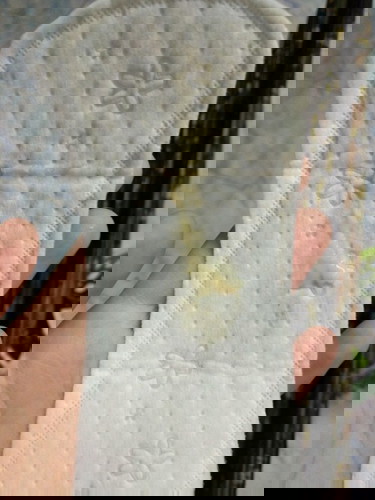 ตกขาวแบบนี้อันรายหรือป่าว?