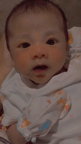 ลูกไม่ถ่ายหลายวัน+ตดเหม็นมาก