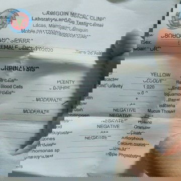 Mataas po ba uti ko?