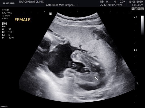 เพศอะไรคะช่วยดูที