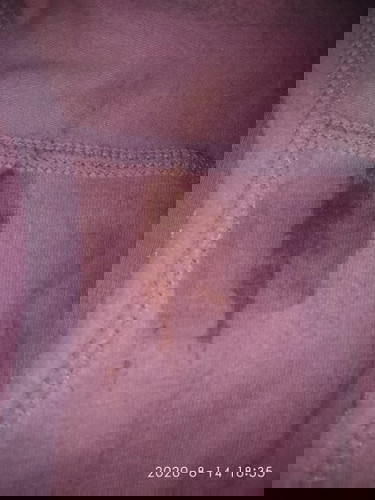 Jika keluar flek seperti ini apakah berbahaya