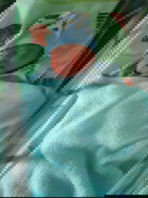 เจ็บปวดที่งดงาม