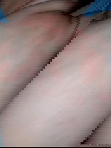 Its Normal?