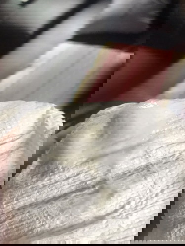 มูกขาวๆนี่คืออะไรคะ