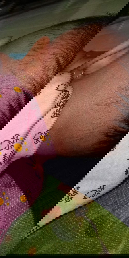 biang keringat atau apa yaa tdk tau namanya