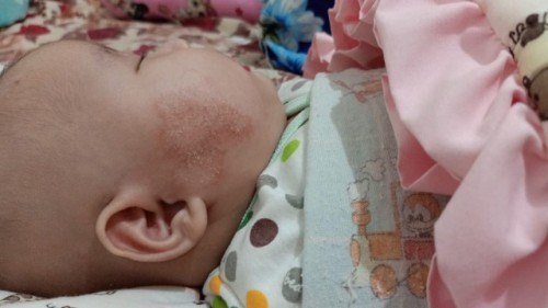Wajah bayi
