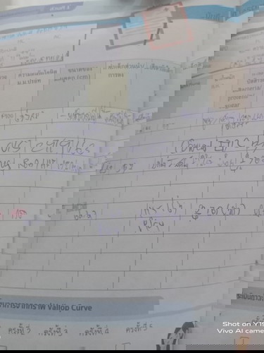 สงสัยท่าเด็ก