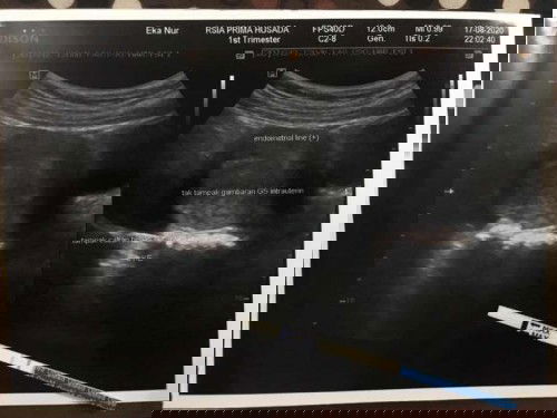 Kehamilan 4minggu 3hr