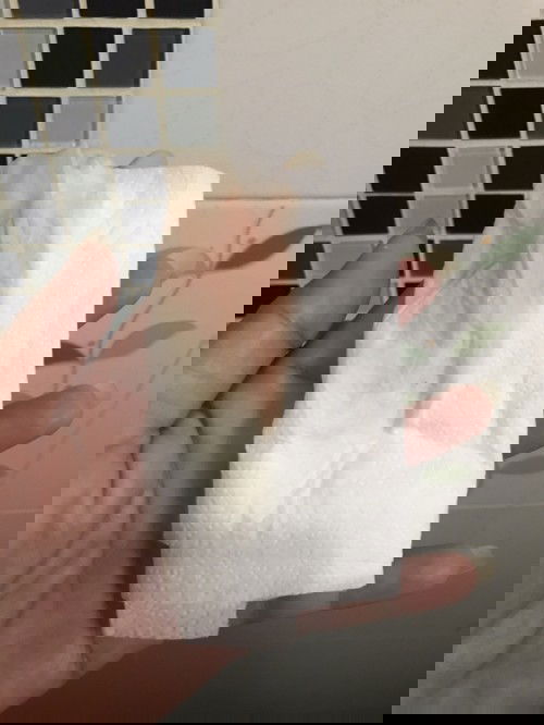 32w2d อยู่ดีๆก็ปวดท้อง