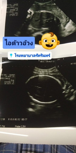 31 w5D  แม่ๆทีม ตุลา ตื่นเต้นไหมคะ